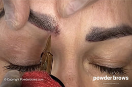 Example Removal procedure